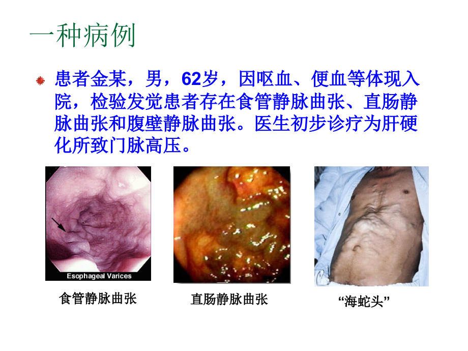 肝门静脉系专题知识宣讲.pptx_第2页