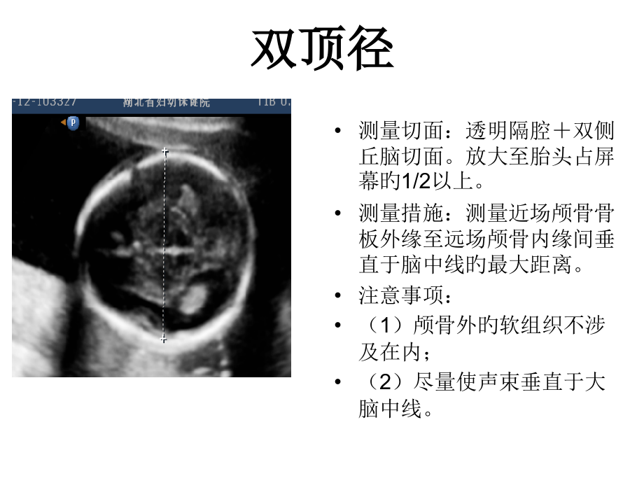 产科超声标准切面张图.pptx_第1页