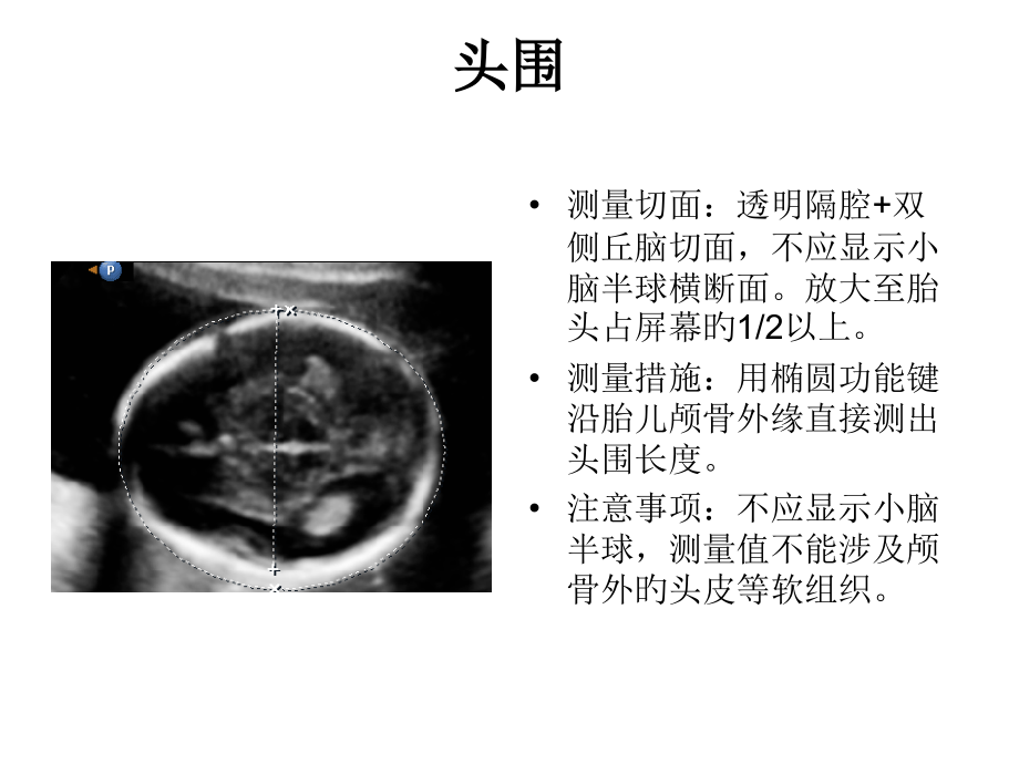 产科超声标准切面张图.pptx_第2页
