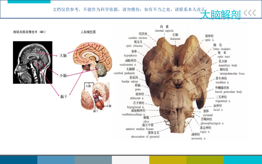 脑外伤患者护理查房.ppt_第2页