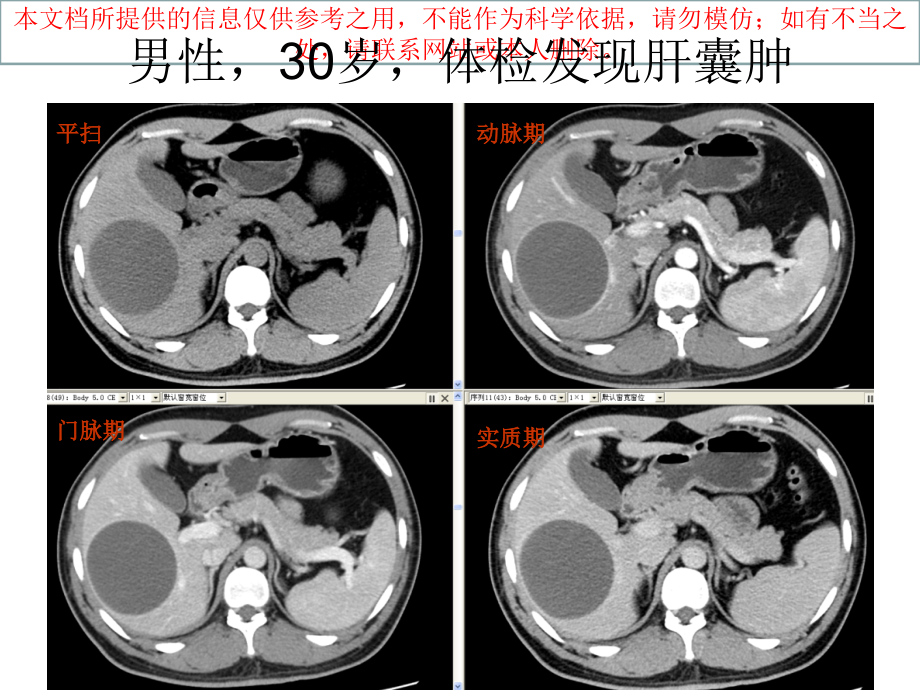 肝胆胰脾常见病多发病培训.ppt_第1页