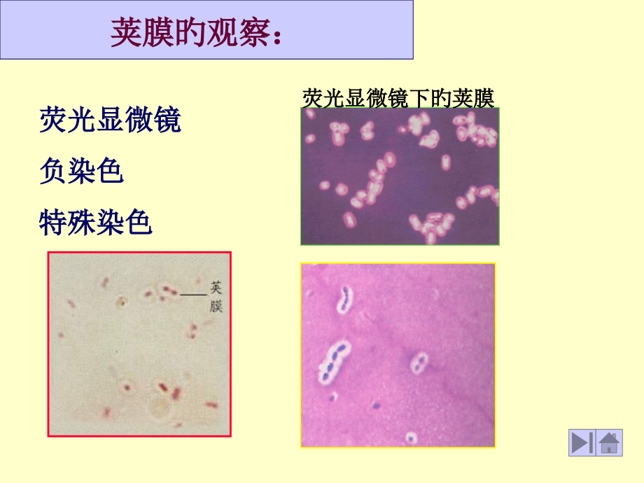 七糖被glycocalyx及其类型.pptx_第2页