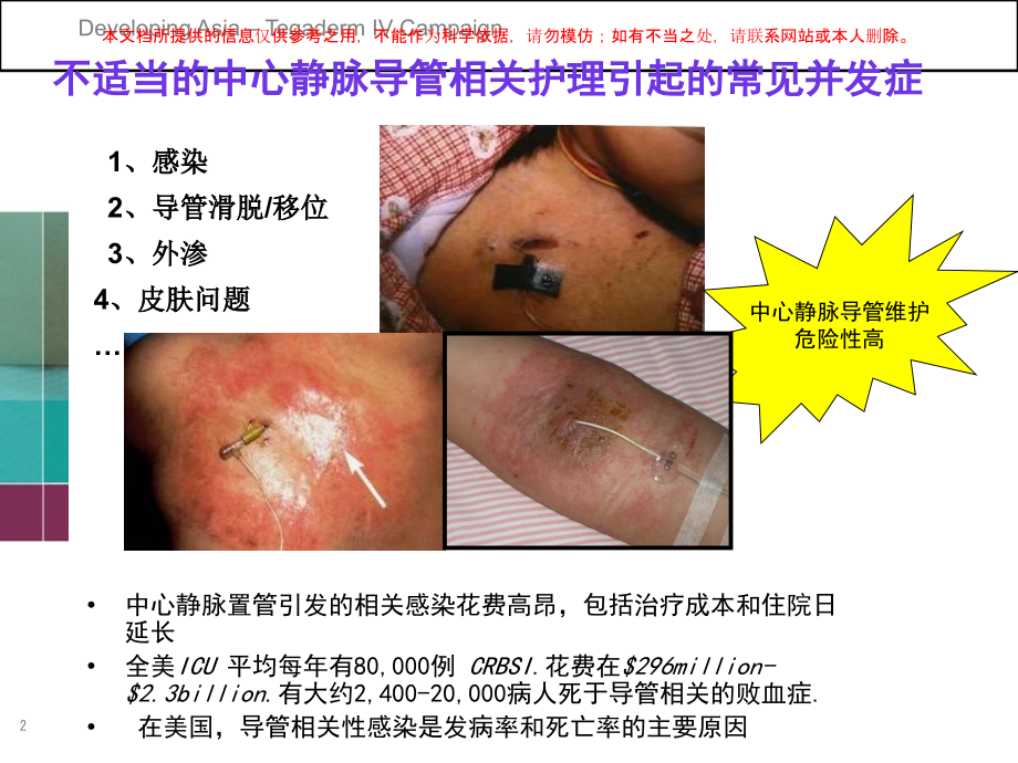 业务学习各种管道的固定固定培训.ppt_第2页