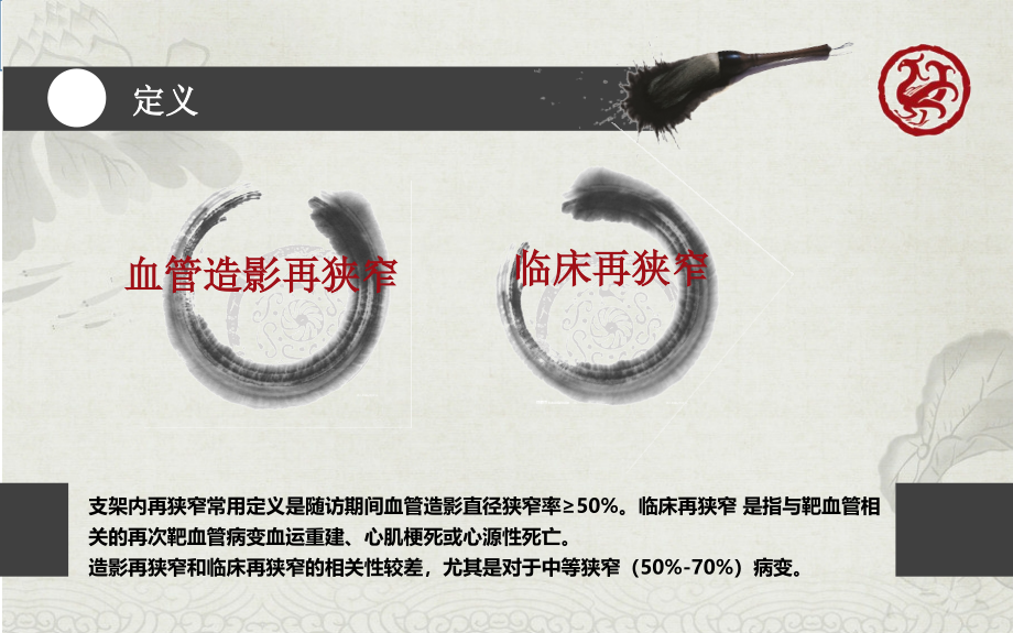 支架内再狭窄培训.ppt_第2页