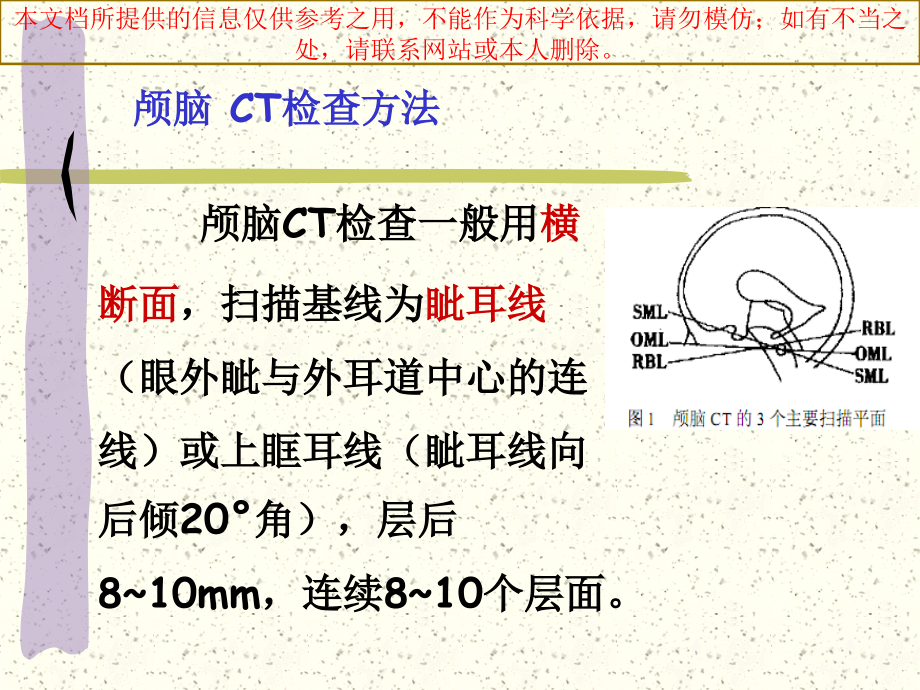 颅脑断层解剖培训.ppt_第2页