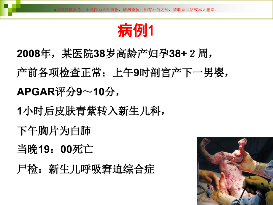 剖宫产和新生儿呼吸疾病.ppt_第1页