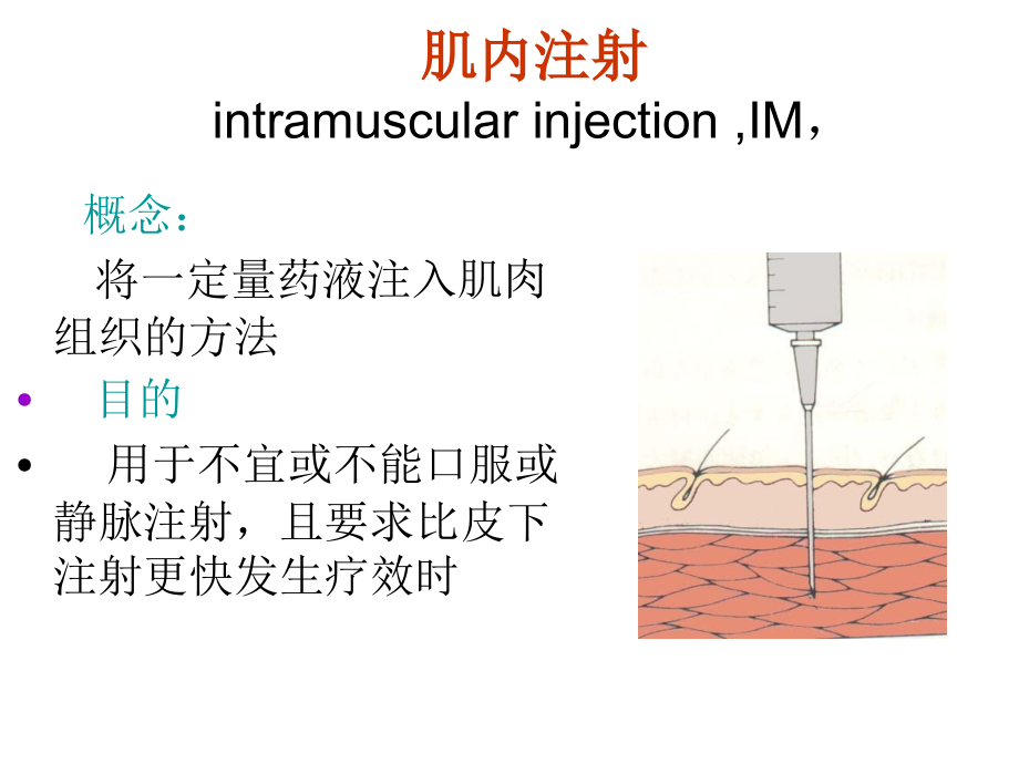 肌肉注射医疗.ppt_第2页