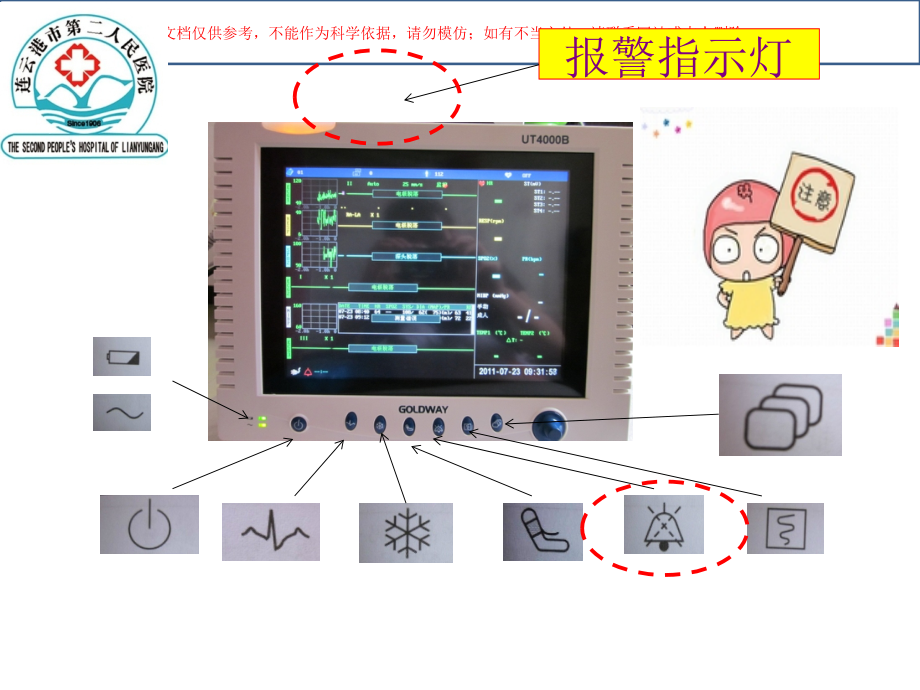 心电监护仪常见问题卞绿.ppt_第2页