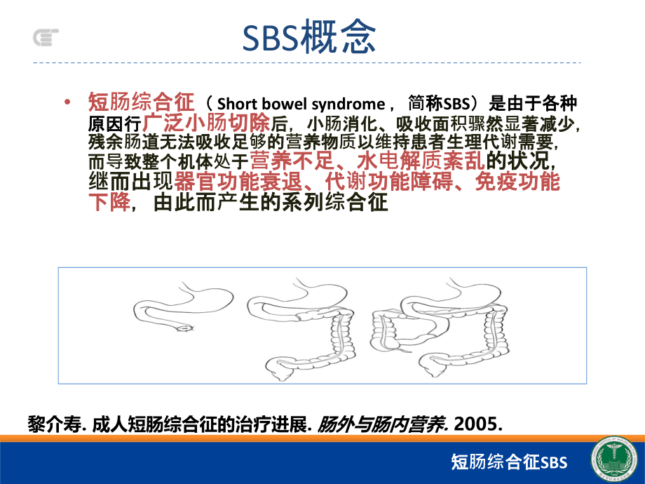 医学短肠综合征SBS专题.ppt_第2页