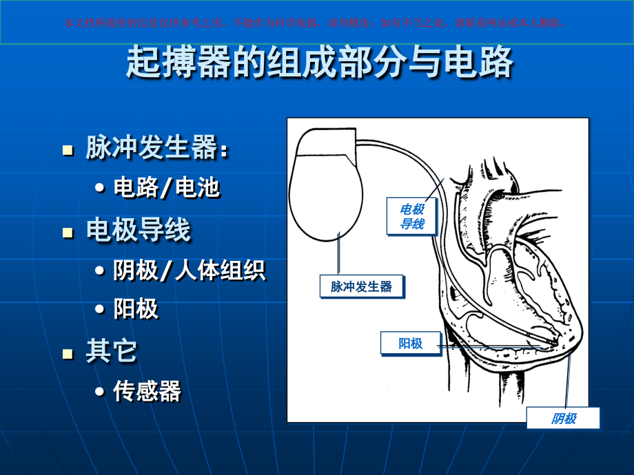 起搏器植入术后护理培训.ppt_第2页