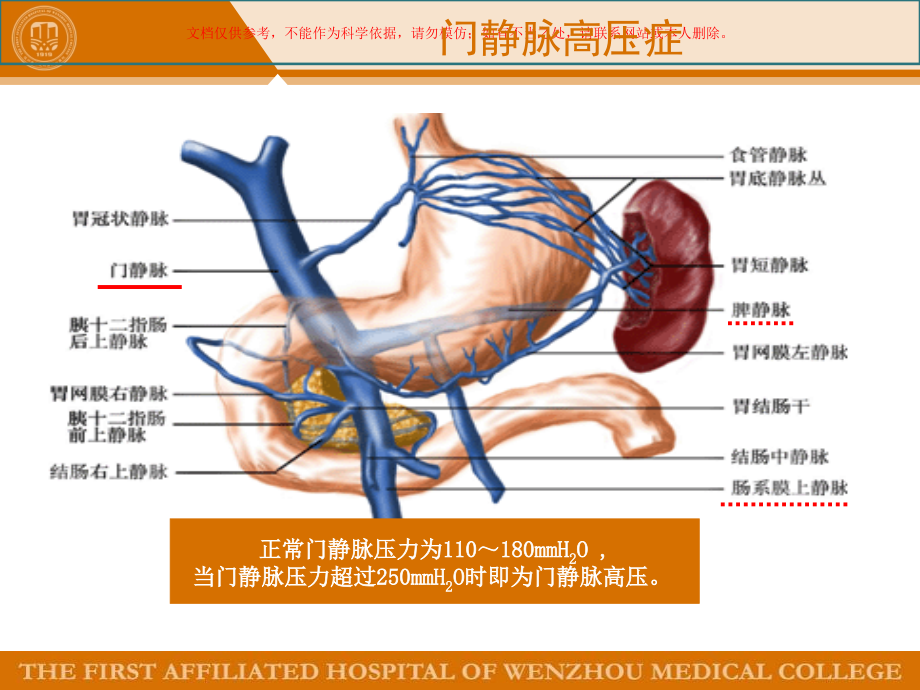 肝硬化门静脉高压.ppt_第2页