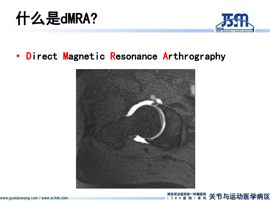 直接髋关节造影核磁共振dMRA保髋外科的基础讲义资料.ppt_第2页