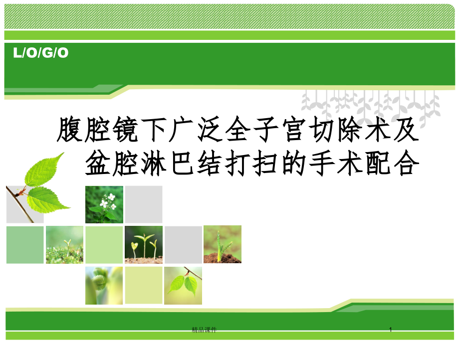腹腔镜下广泛子宫切除及盆腔淋巴结清扫术的手术配合.ppt_第1页