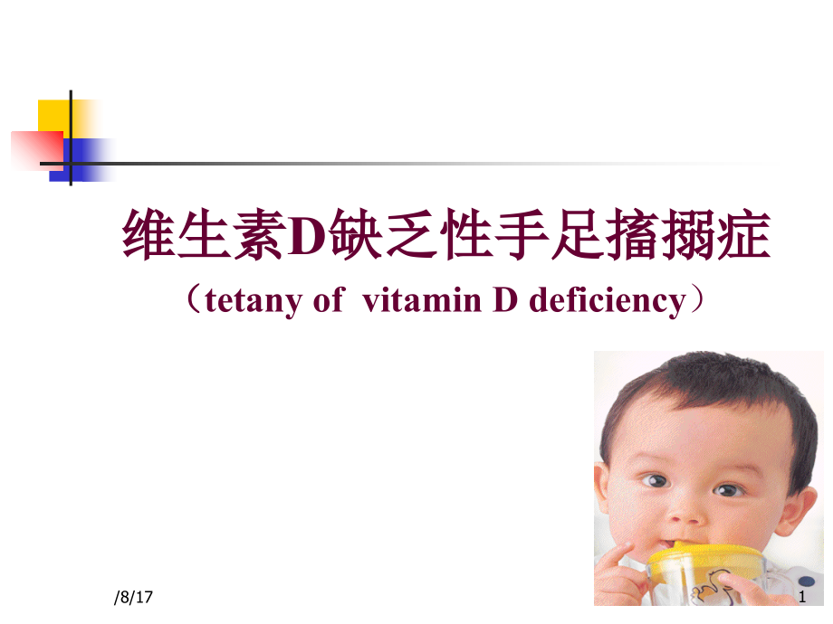 小儿缺钙维生素D缺乏性手足搐搦症.ppt_第1页