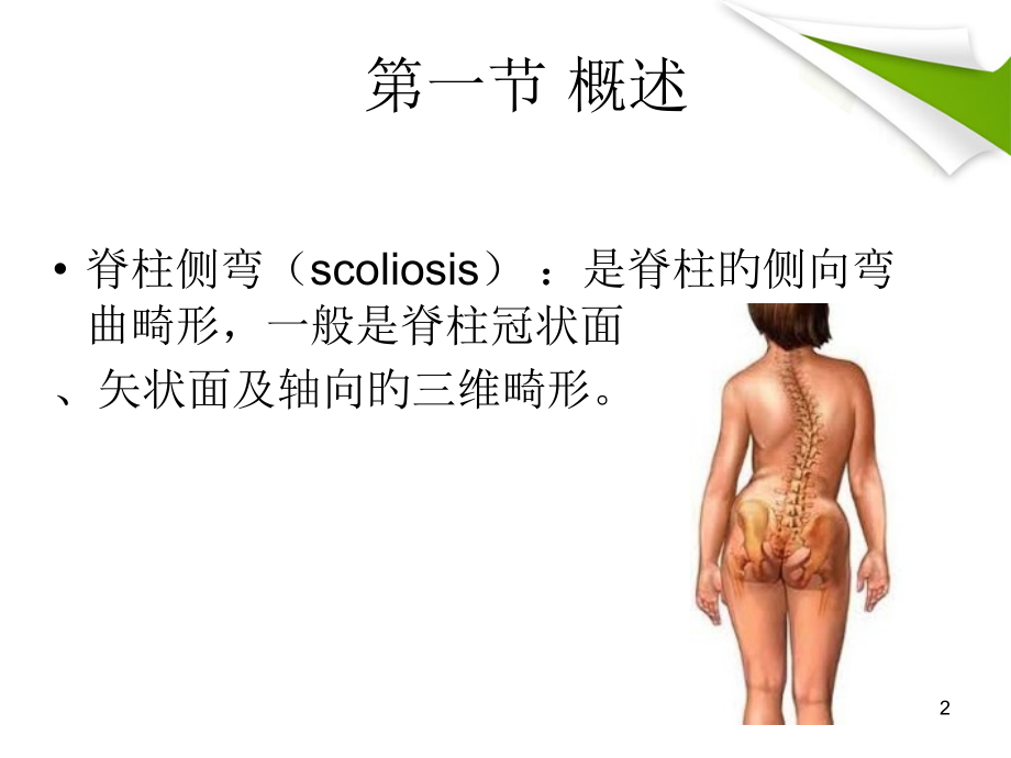 运动学脊柱侧弯.ppt_第2页