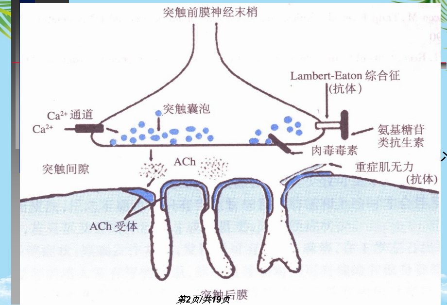 神经病学教学重症肌无力中文.pptx_第2页