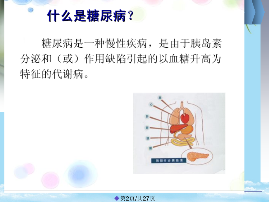 酮症酸中毒护理查房.pptx_第2页