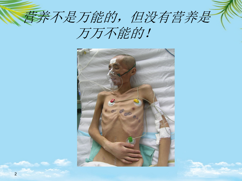 营养支持讲课最终.ppt_第2页
