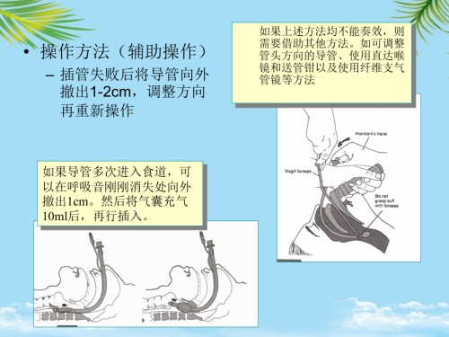 气道的建立与管理.ppt