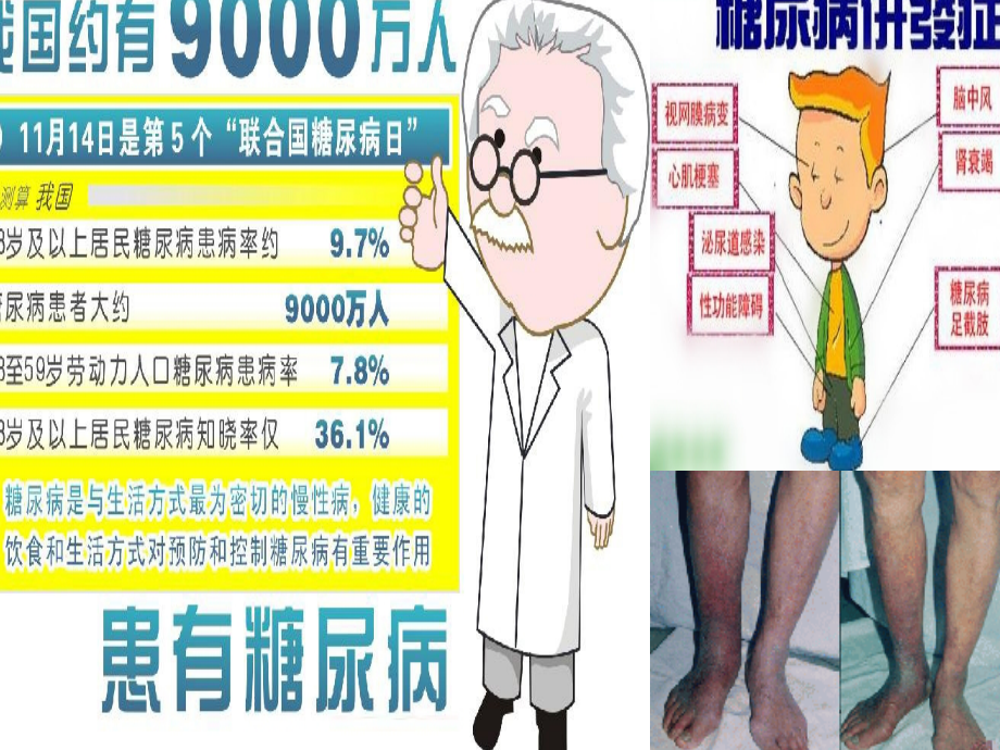 药理学胰岛素和口服抗糖尿病药.ppt_第2页