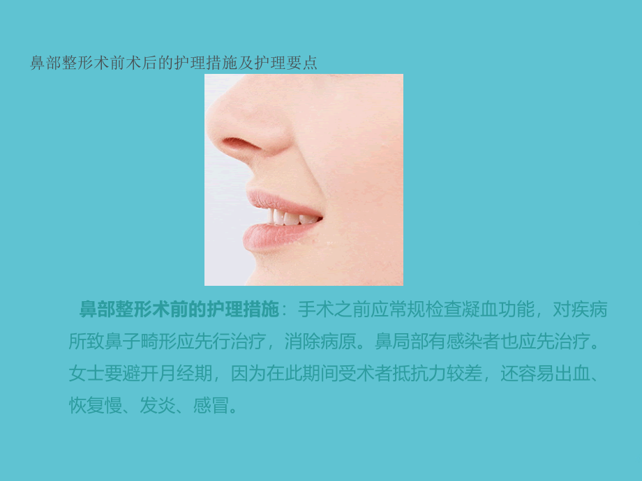 鼻部整形术前术后的护理措施及护理要点.ppt_第2页
