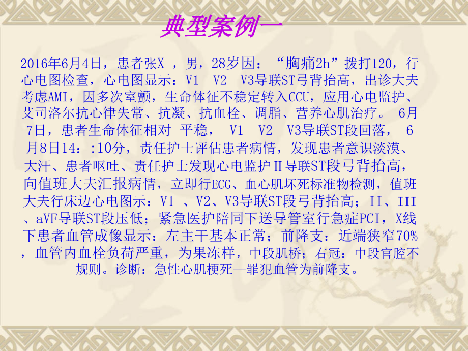 护理人员常见异常心电图识别.ppt_第2页