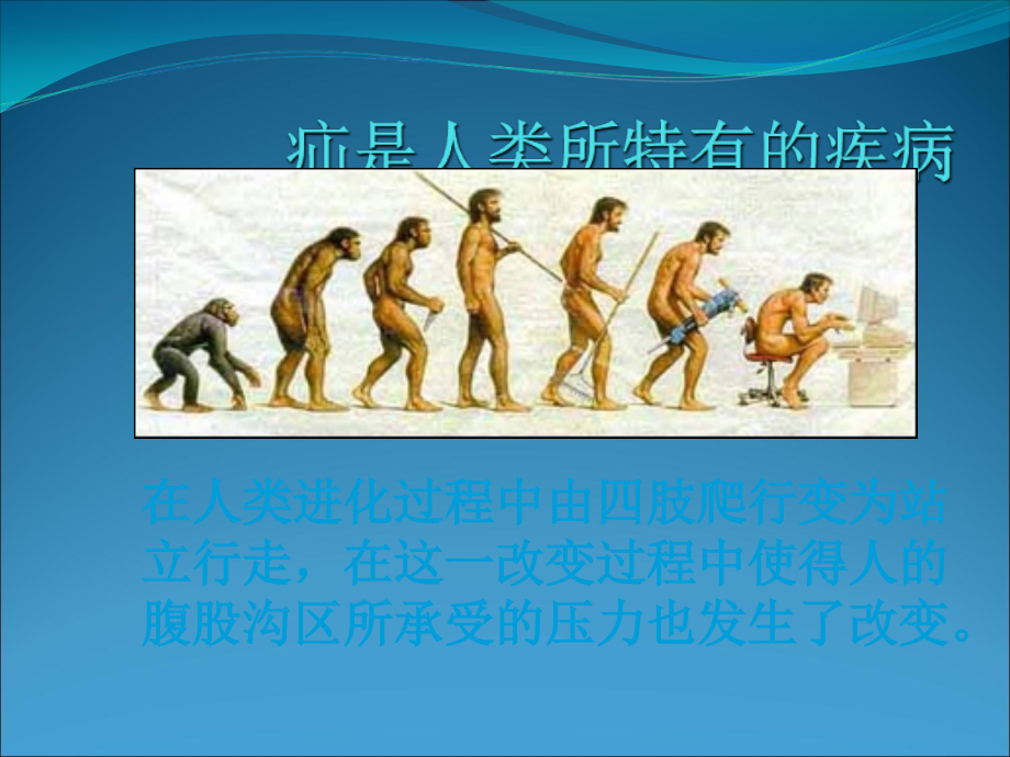 腹股沟疝诊断及治疗进展.ppt_第2页