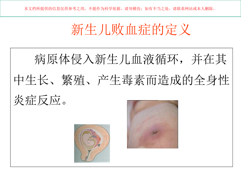 新生儿脓毒血症培训.ppt_第1页