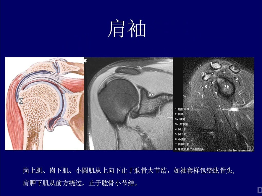 肩关节磁共振影像诊疗培训.ppt_第2页