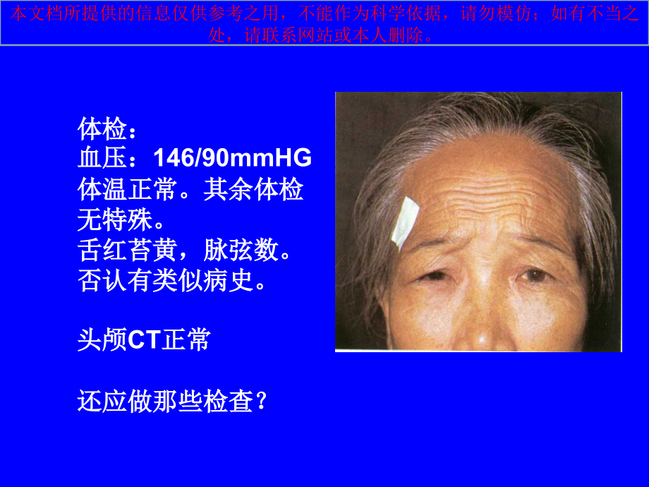 绿风内障医学培训.ppt_第1页
