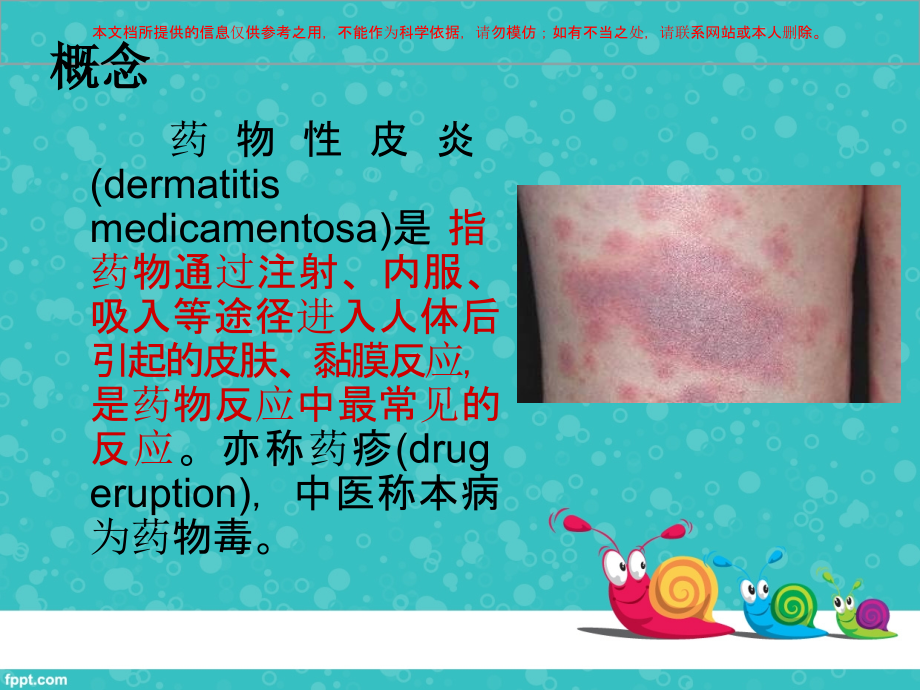 药疹护理查房培训.ppt_第1页