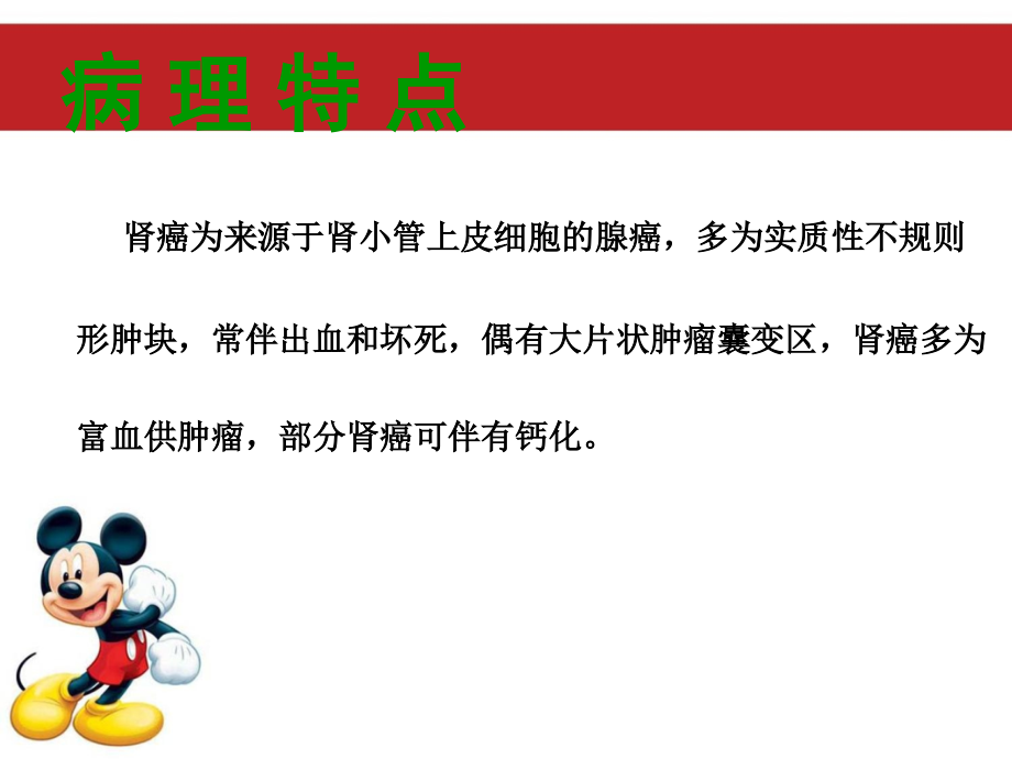 肾癌影像诊断优质.ppt_第2页