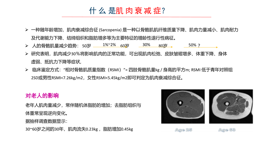 老肌肉衰减症PPT医学.ppt_第2页