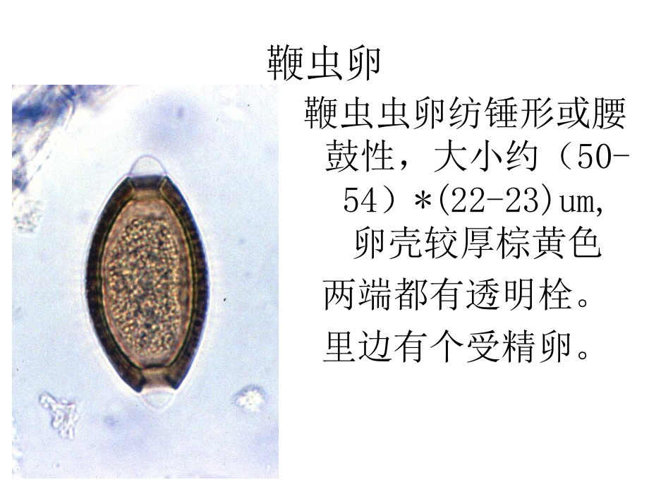 医学寄生虫学虫卵总结和图片.ppt_第2页