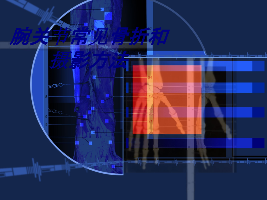 腕关节常见骨折和摄影方法.ppt_第1页