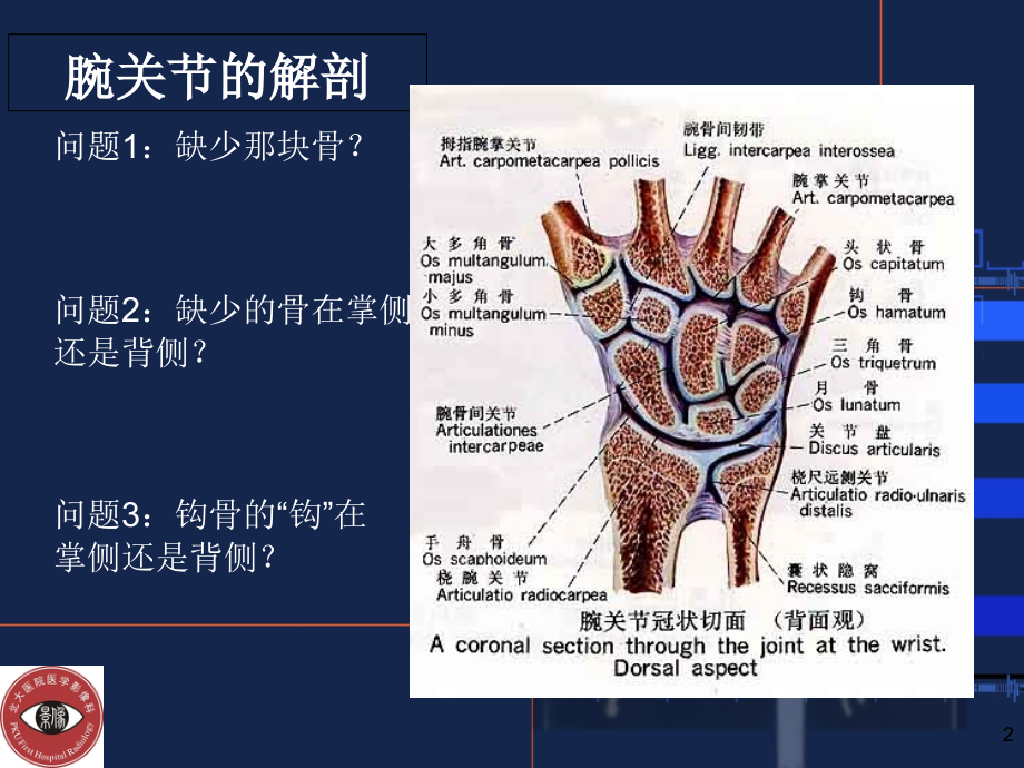 腕关节常见骨折和摄影方法.ppt_第2页