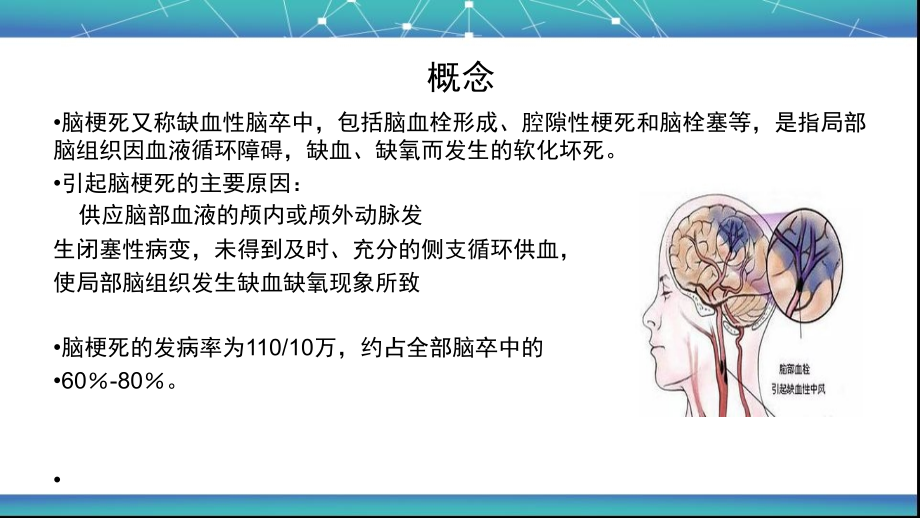 脑梗死的业务学习.ppt_第2页