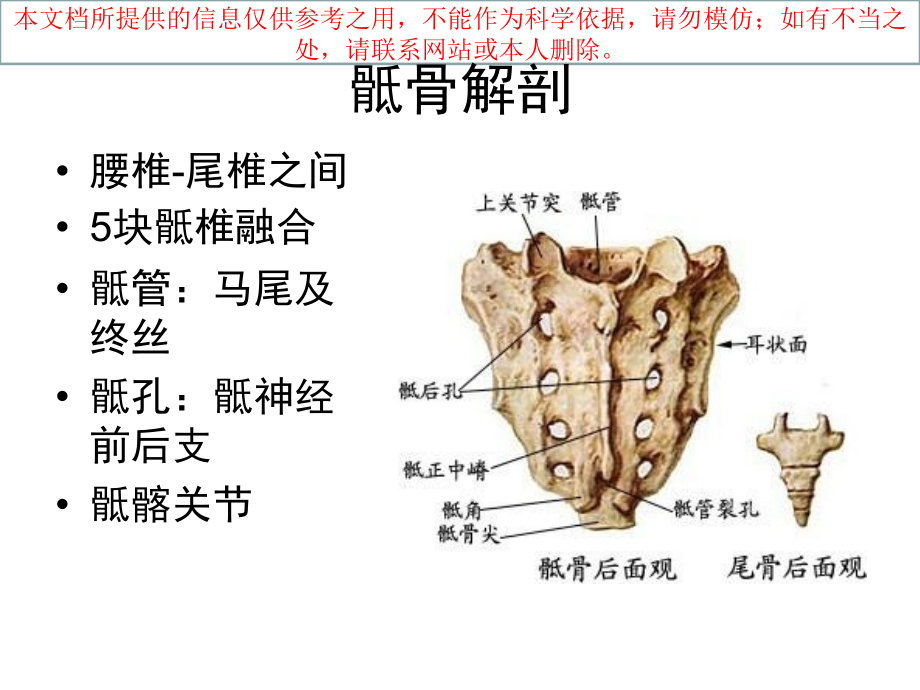 骶骨肿瘤专业知识宣讲培训.ppt_第1页