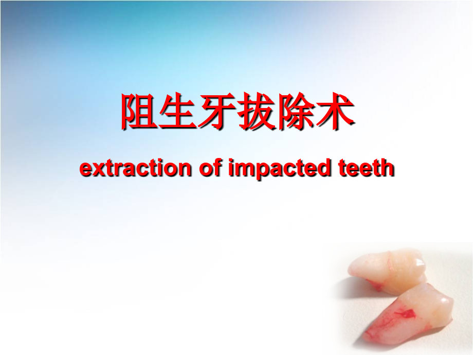 医学阻生齿拔除专题知识讲座专题.ppt_第2页