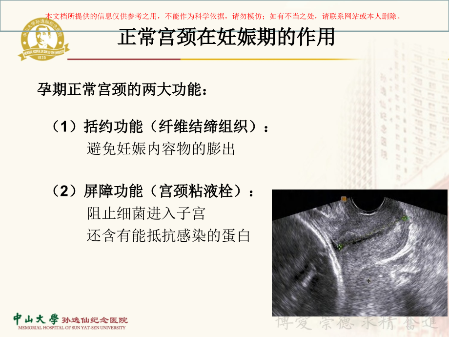 紧急宫颈环扎术的手术指征及术后管理培训.ppt_第1页