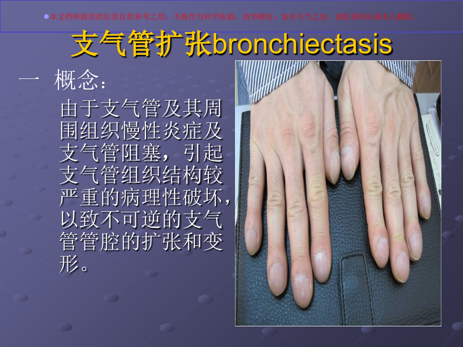 支气管扩张症护理查房培训.ppt_第1页