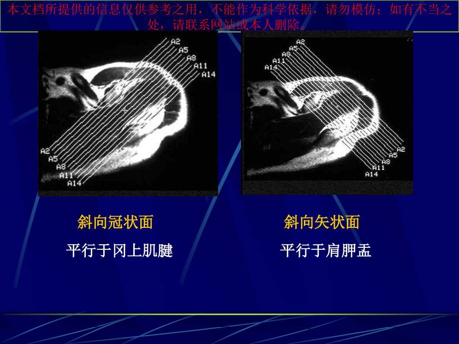 肩关节的MRI培训.ppt_第2页