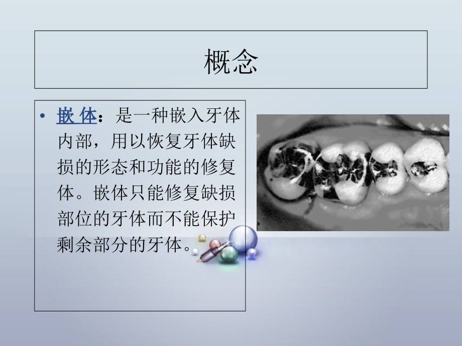 嵌体(包括图解).ppt_第2页