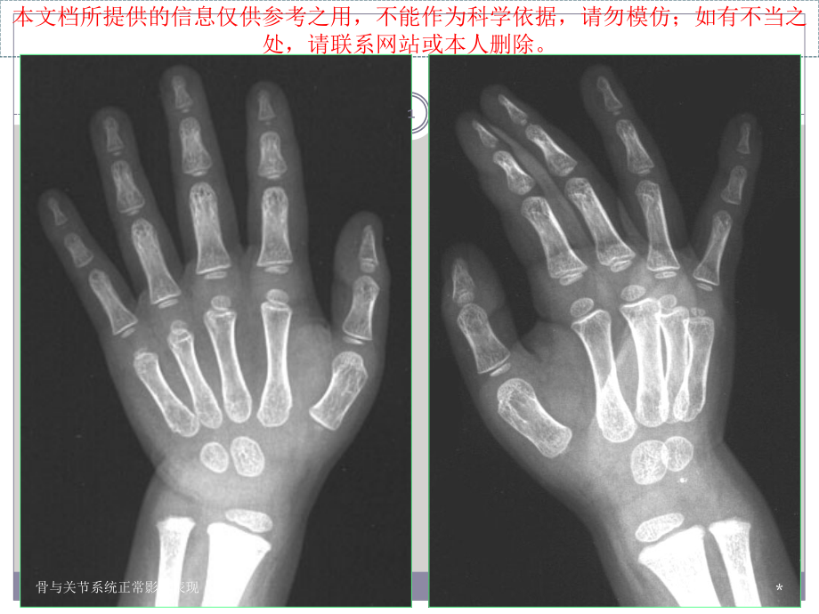 骨和关节系统正常影像表现培训.ppt_第1页