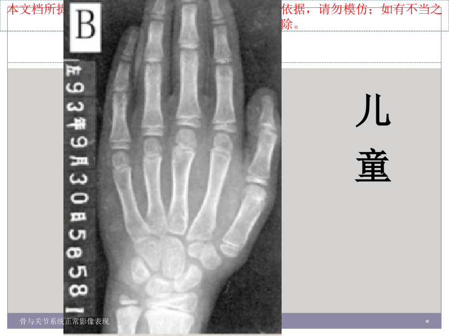 骨和关节系统正常影像表现培训.ppt_第2页