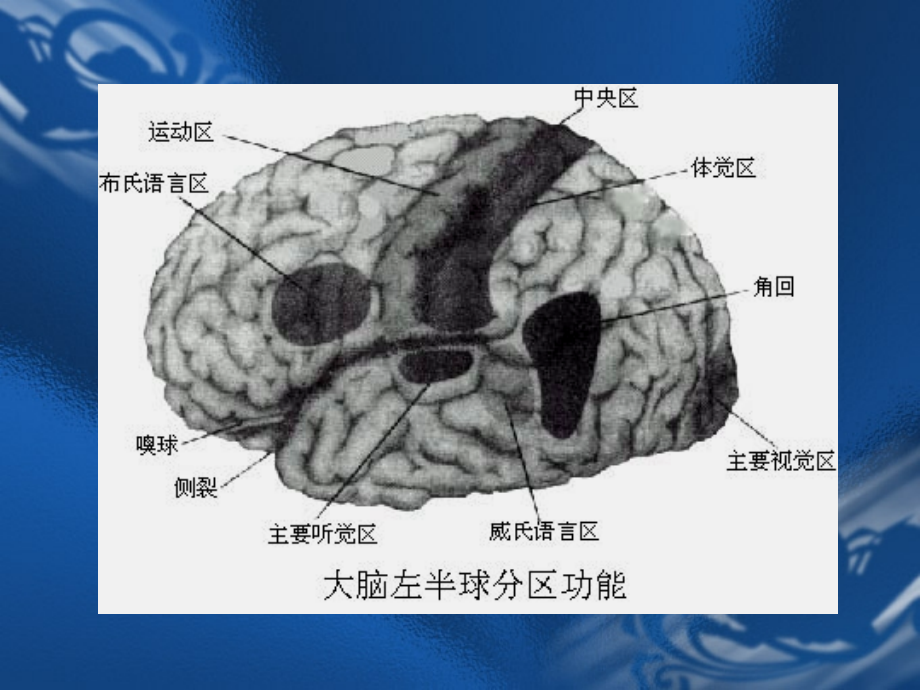医学MRI解剖颅脑专题课件.ppt_第2页