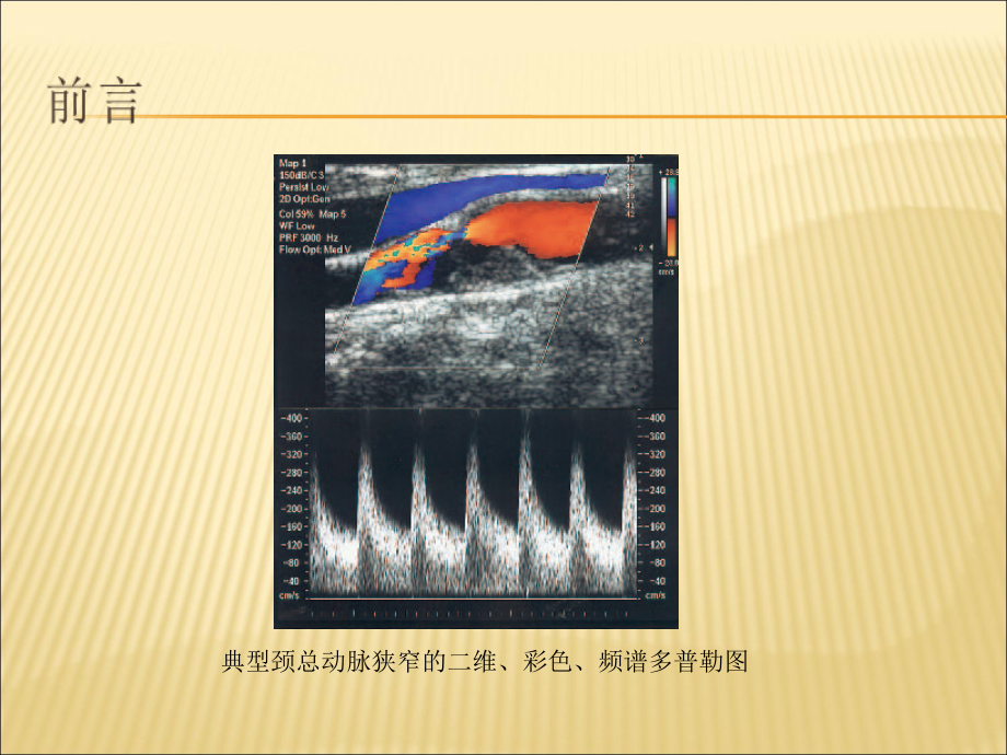 医学课件血管超声仪器调节基础.ppt_第1页