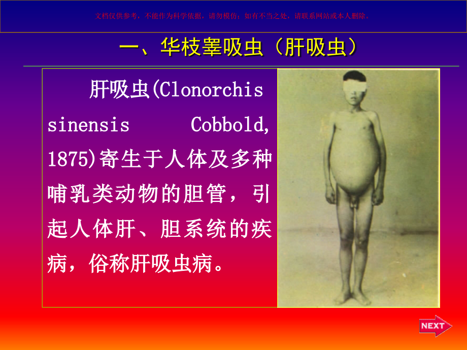 华枝睾吸虫(肝吸虫)课件.ppt_第1页