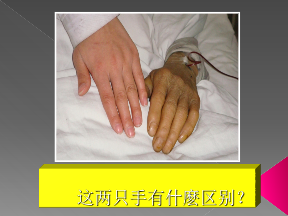 医学课件诊疗学黄疸专业医学知识宣讲.ppt_第1页