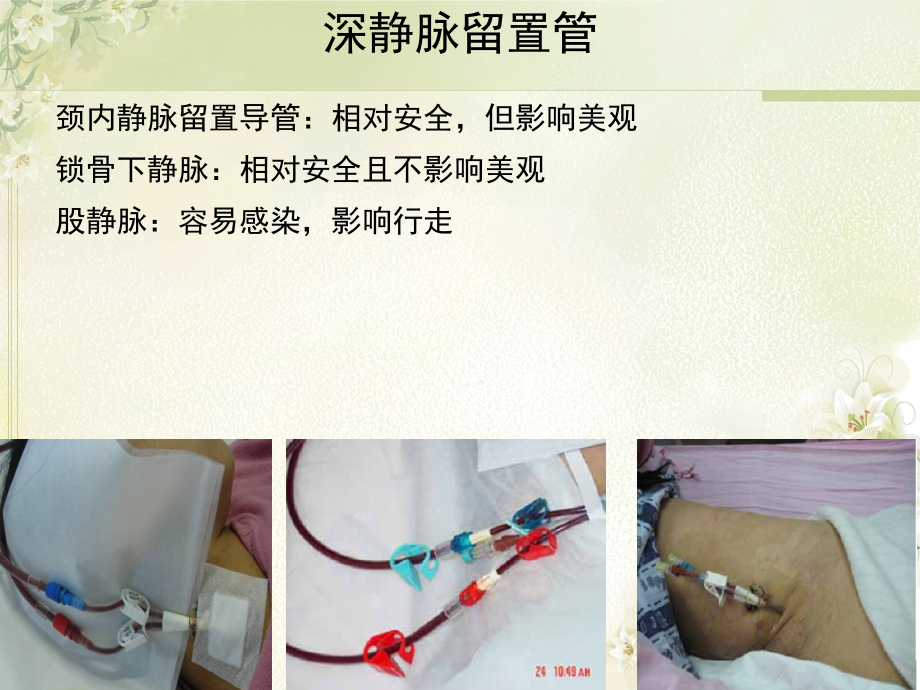血液透析患者血管通路的护理主题讲座课件.ppt_第2页